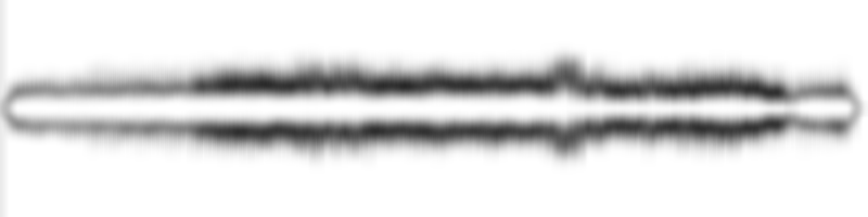 waveform